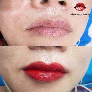 Phun môi Collagen Công Nghệ Hàn
