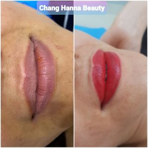 Phun môi Collagen Công Nghệ Hàn