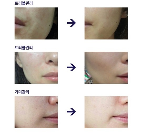 Lưu bản nháp tự động Lưu bản nháp tự động