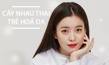 Cấy nhau thai cừu