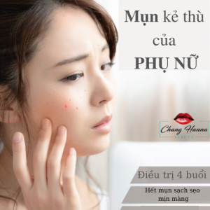Mụn Kẻ Thù Của PhỤ NỮ