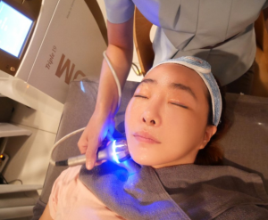 Vi Kim điều Trị Sẹo