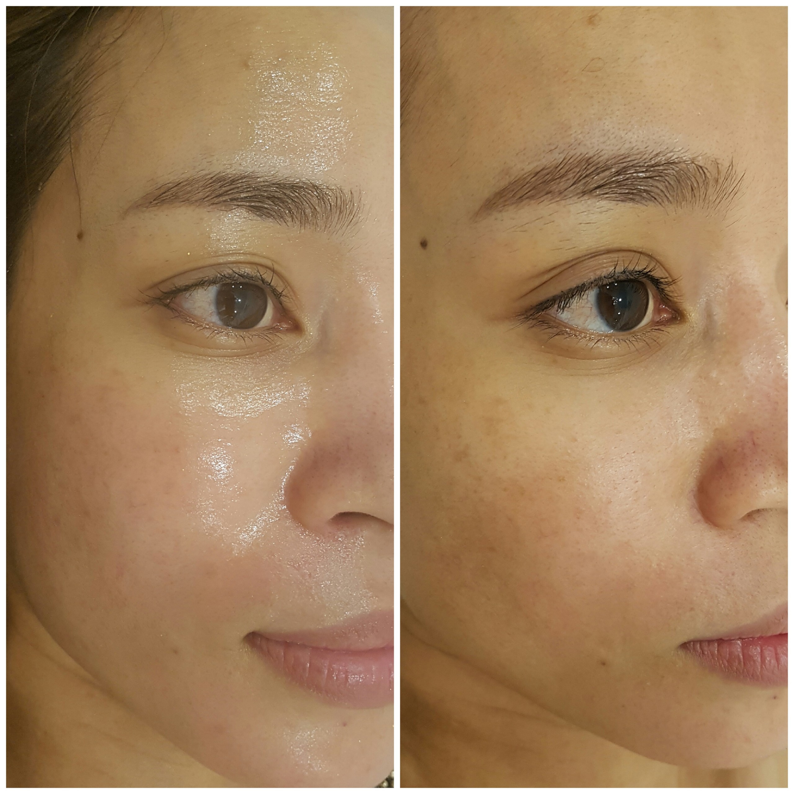 Chăm sóc da chuyên sâu - Chuẩn công nghệ Hàn Quốc