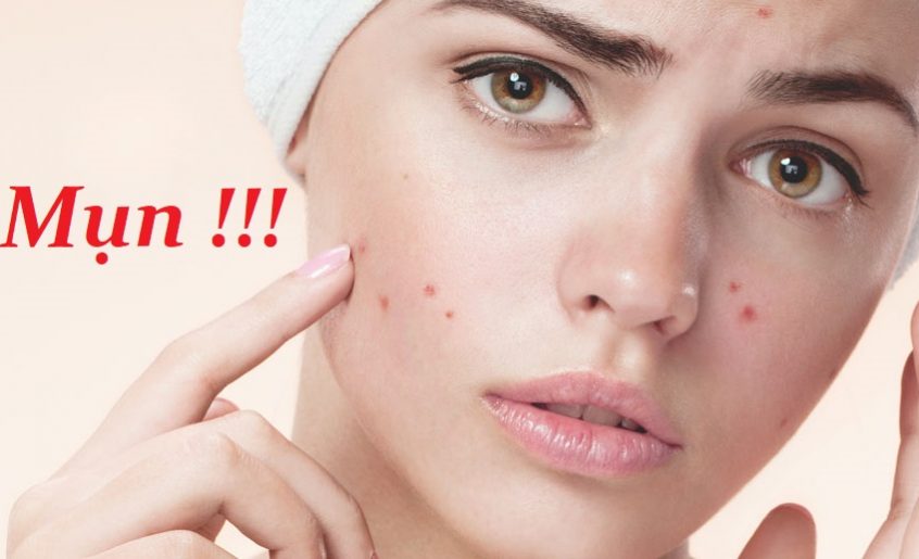 Chăm sóc da và trị mụn ẩn dưới da như thế nào cho hiệu quả?