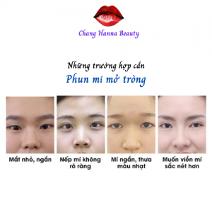 Những ai cần phun mí