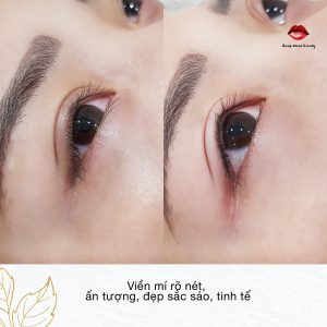 Phun mí mở tròng Hàn Quốc