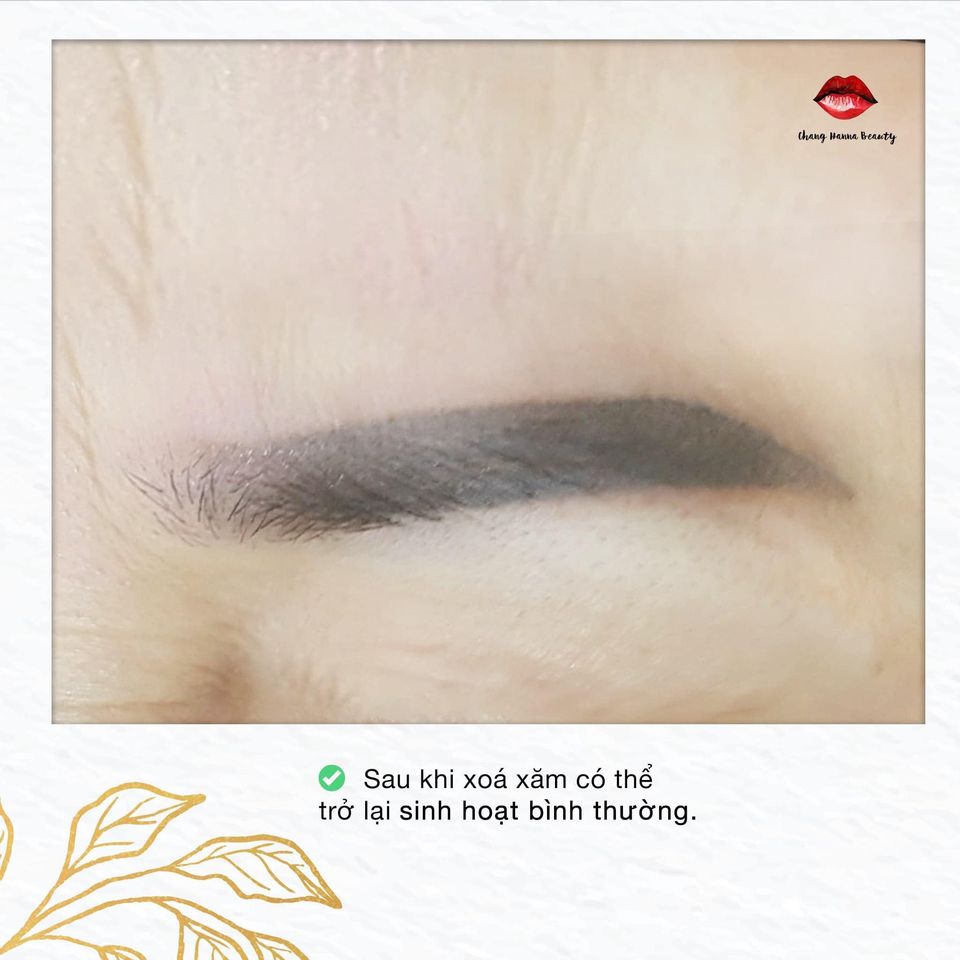 Hình ảnh khách hàng sử dụng công nghệ chỉnh sửa lông mày