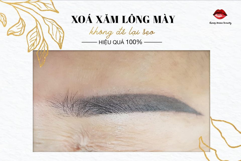 Xóa Mày