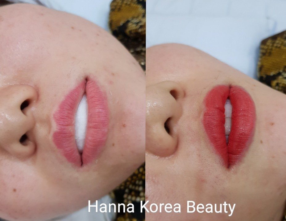phun môi Collagen spa chang hanna