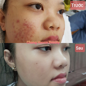spa chang hanna