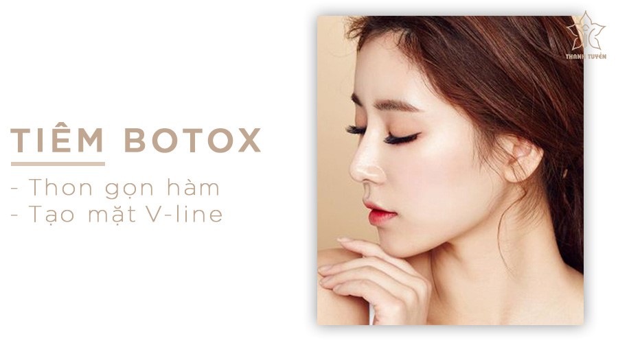 xóa cằm vuông bằng botox