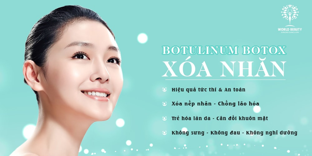 Botox Xóa nhăn đuôi mắt