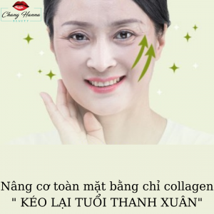 Căng da Mặt bằng chỉ collagen Hàn Quốc