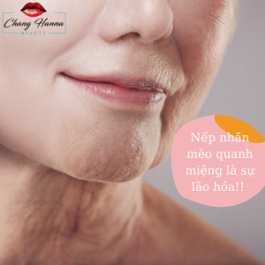 Nếp Nhăn Mèo Quanh Miệng 1png