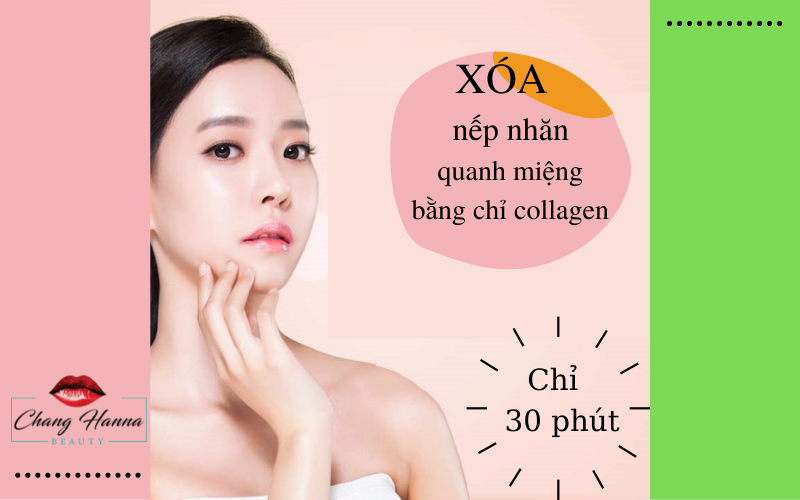Xóa Nhăn Nếp Nhăn Quanh Miệng Bằng Chỉ Collagen