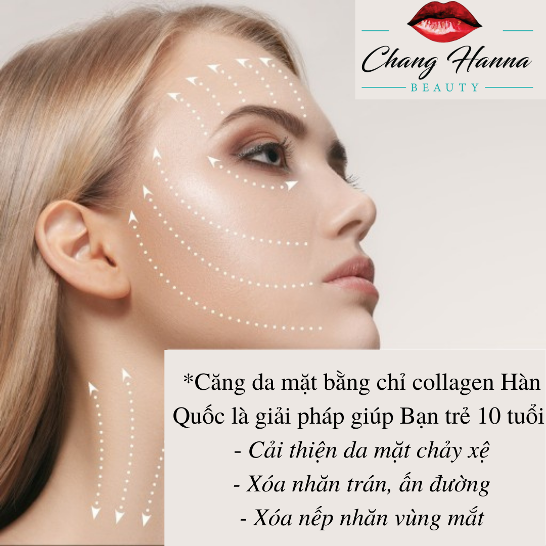 căng da mặt bằng chỉ Collagen Hàn Quốc