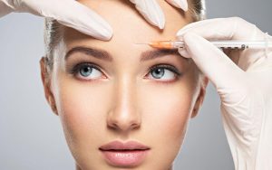 Xóa nhăn trán bằng botox