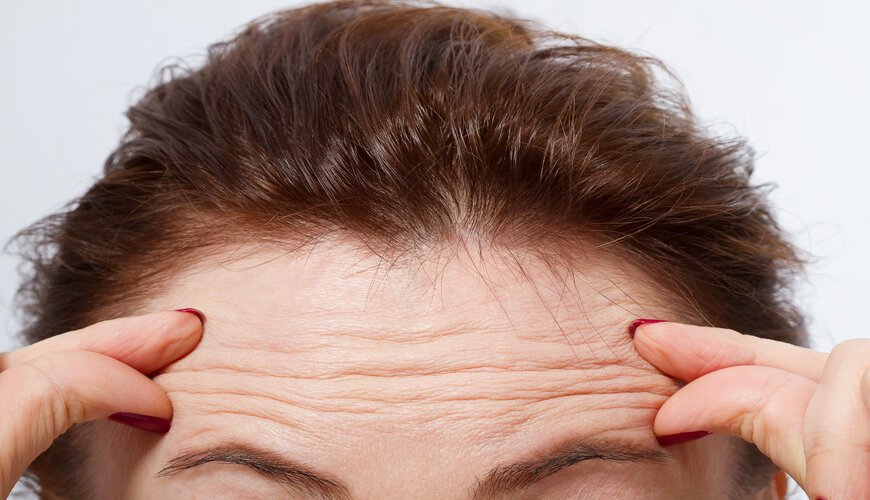 Xóa nhăn trán bằng botox