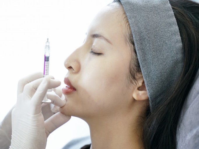Thực hiện tiêm độn cằm không phẫu thuật bằng filer