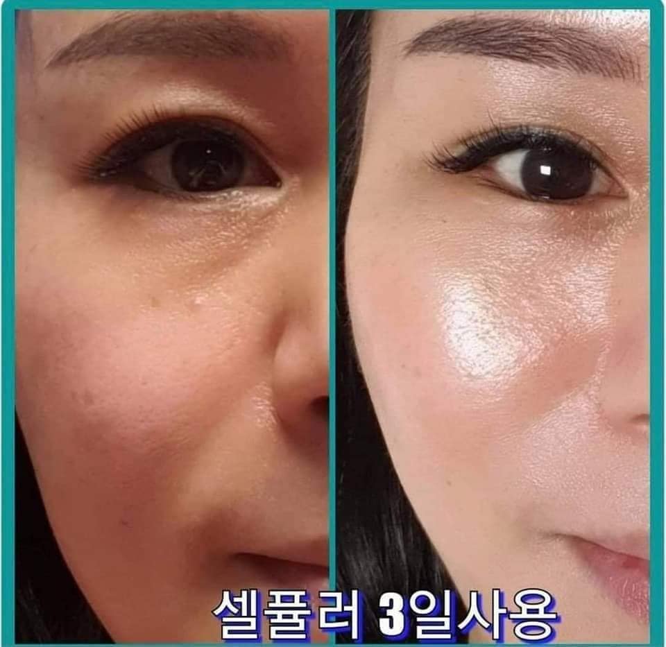 Spa làm đẹp Hàn Quốc tại Hà Nội. chang hanna beauty