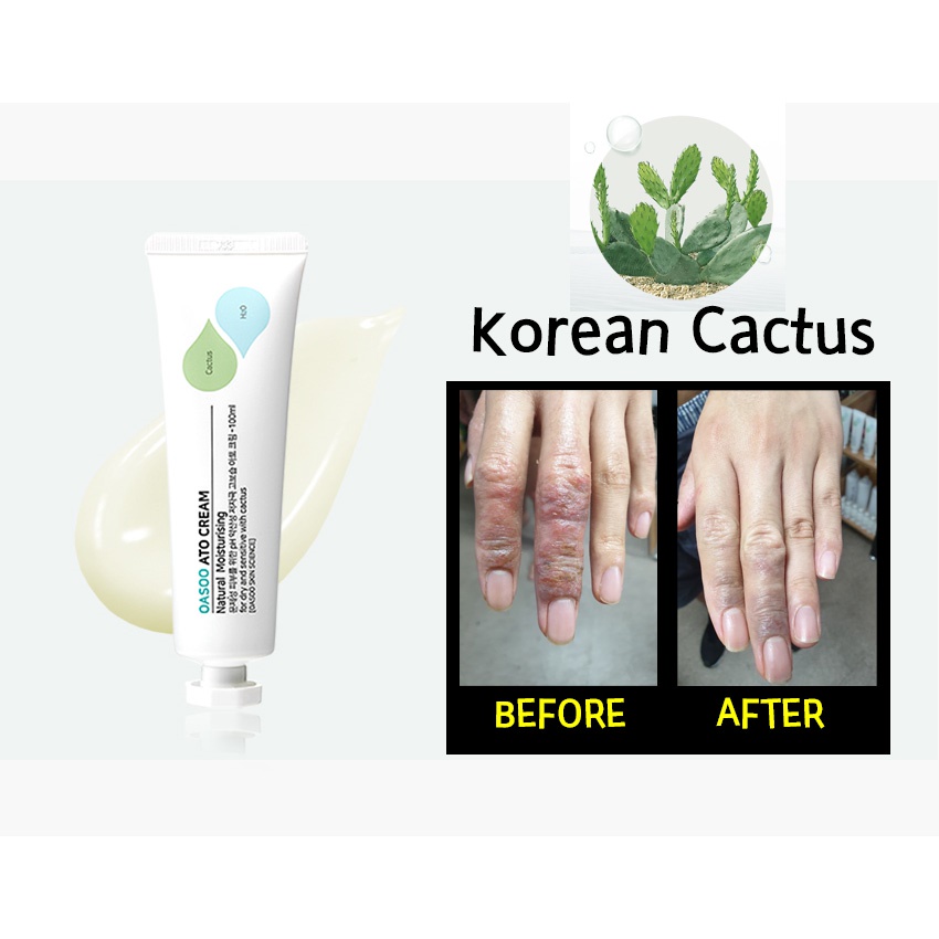 Kem đặc trị mụn Ato Repair Cream - Sản phẩm trị mụn số 1