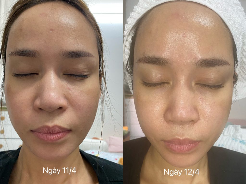 CELL FULLER - SIÊU PHẨM ĐÁNH THỨC TẾ BÀO