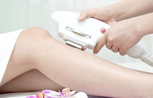 Triệt lông chân công nghệ IPL