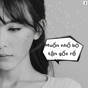 Nám da nổi lo của phụ nữ