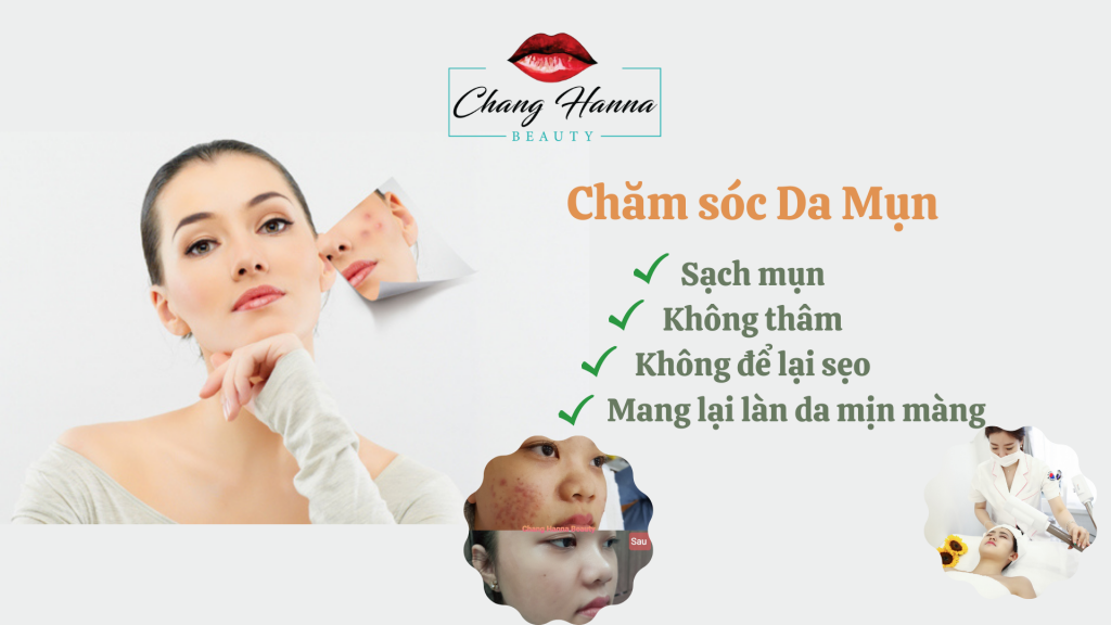 Spa Chăm Sóc Da Mụn