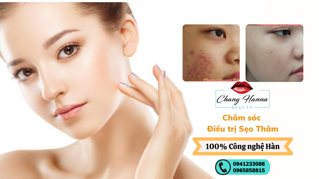 Chăm sóc điều trị sẹo thâm