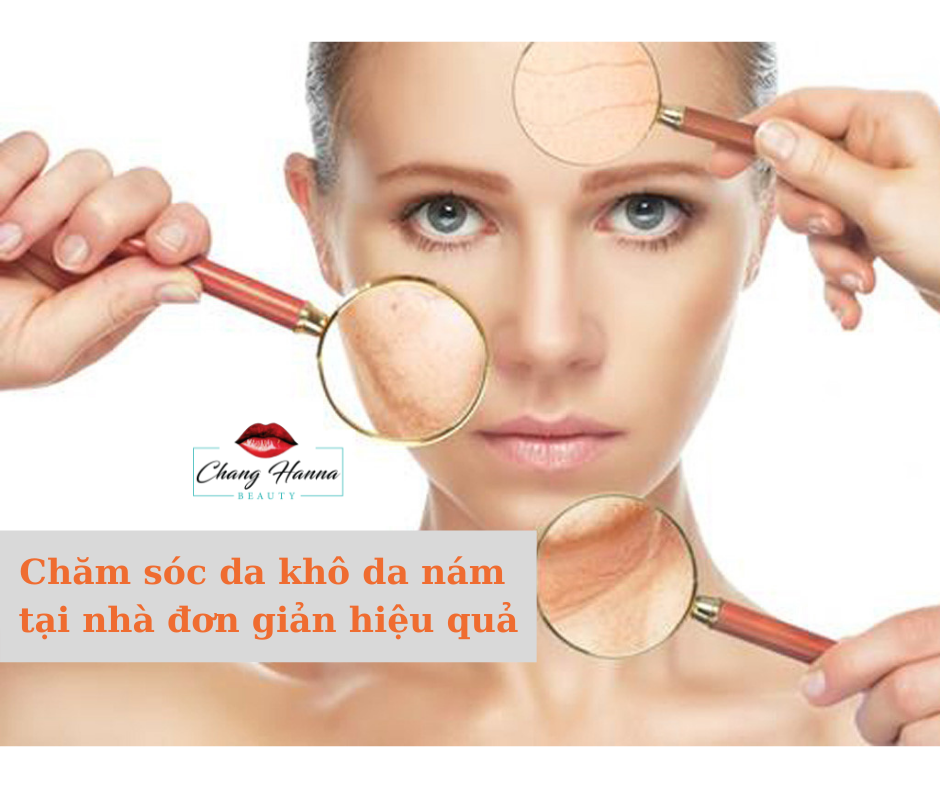Cách chăm sóc da khô da nám tại nhà đơn giản hiệu quả