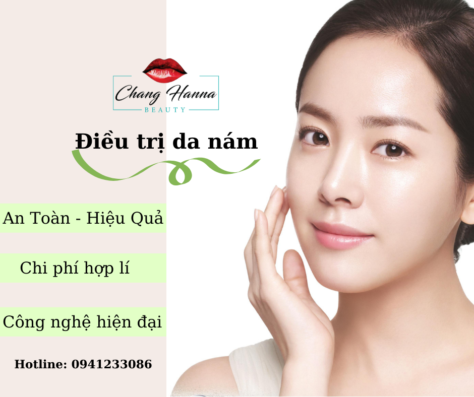 spa nào điều trị da nám