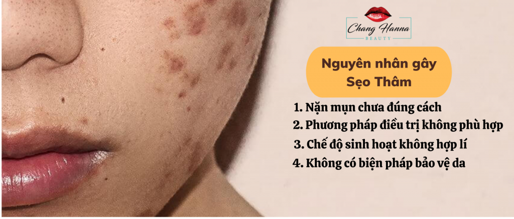 Nguyên Nhân Gây Sẹo Thâm