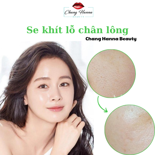 Chăm sóc se khít lỗ chân lông