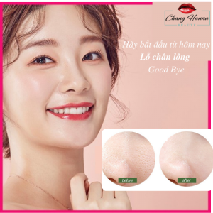Lỗ Chân Lông ảnh Bìa