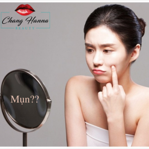 Mụn