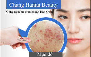 Mụn đỏ