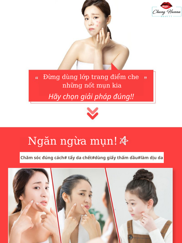 phương pháp cải thiện mụn. Chang Hanna Beauty