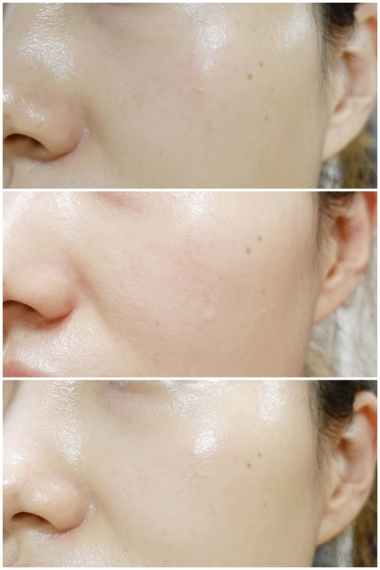 Serum trắng da IMESO White Toning Ampoule