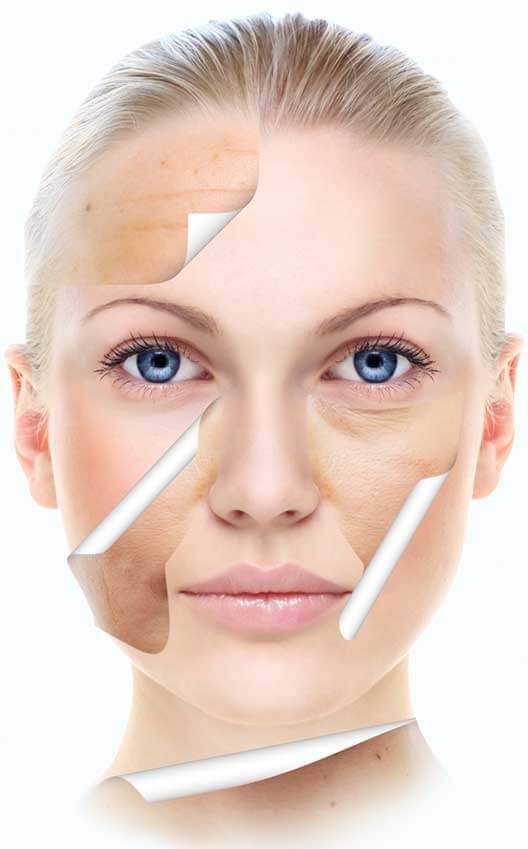 Tế bào gốc nám Hàn Quốc