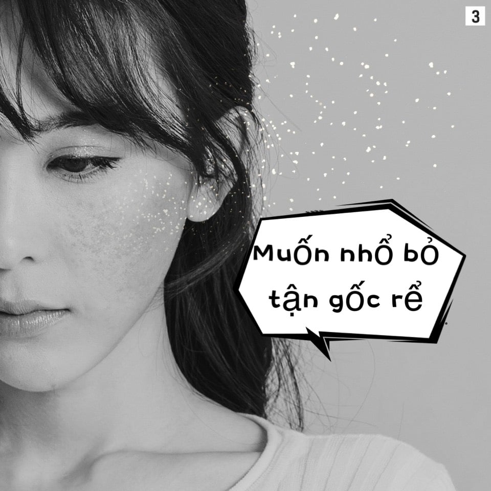Tế bào gốc trị nám