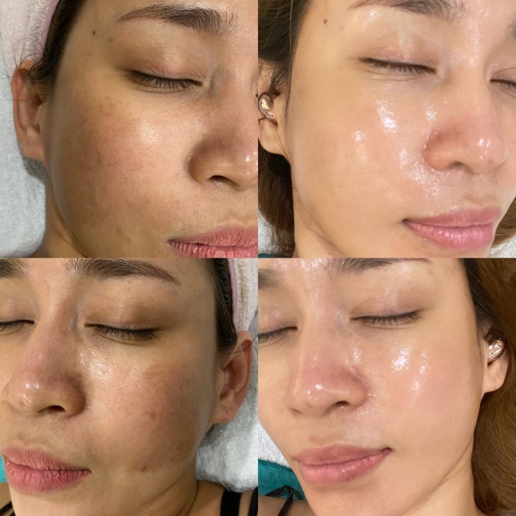 1. Serum tế bào gốc Vitamin C